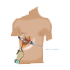 Gallbladder-removal-surgery-150x150